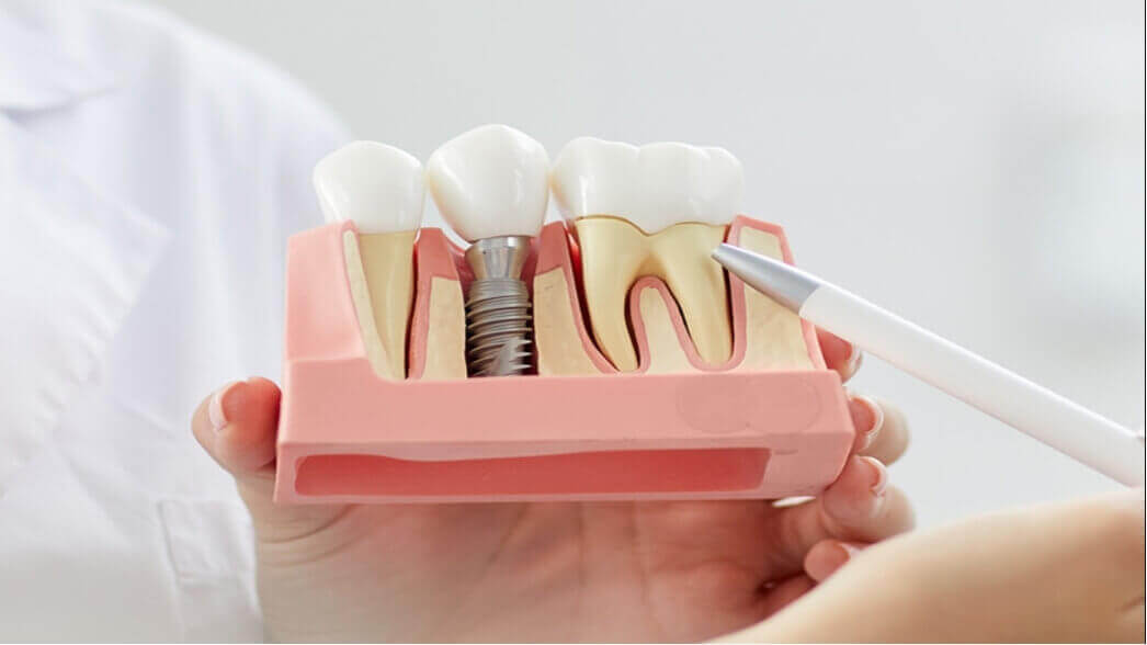 新悅美學牙醫診所的服務項目圖片