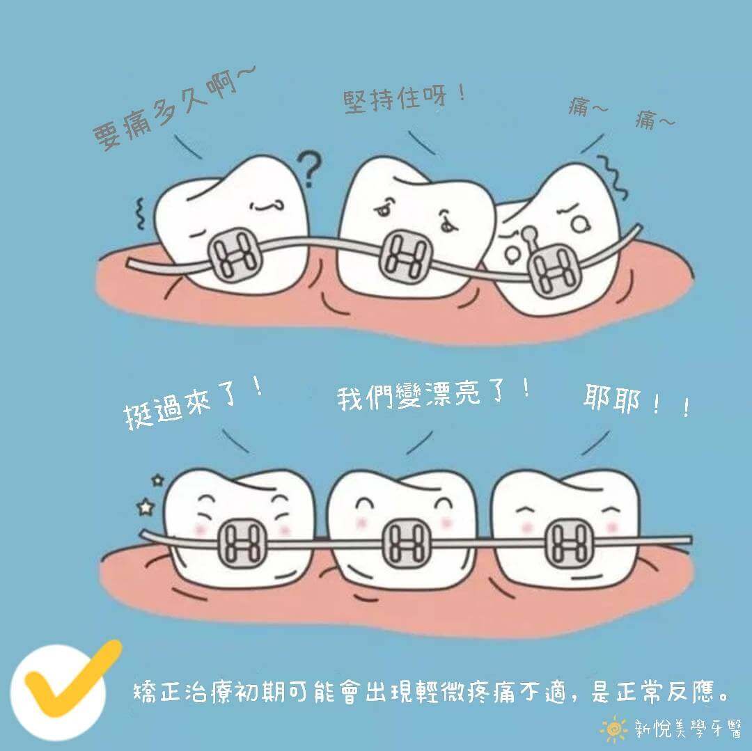 新悅美學牙醫診所的牙醫衛教案例圖片
