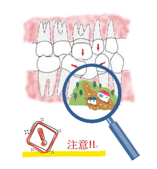 新悅美學牙醫診所的牙醫衛教案例圖片