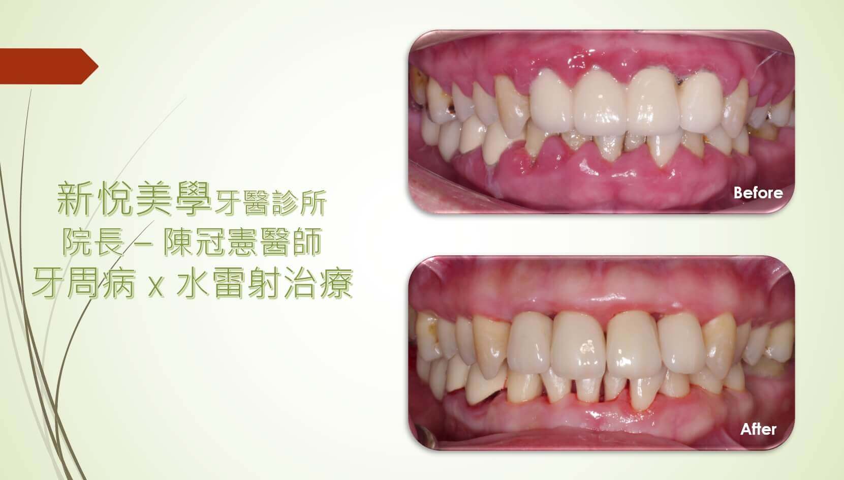 新悅美學牙醫診所的案例分享圖片