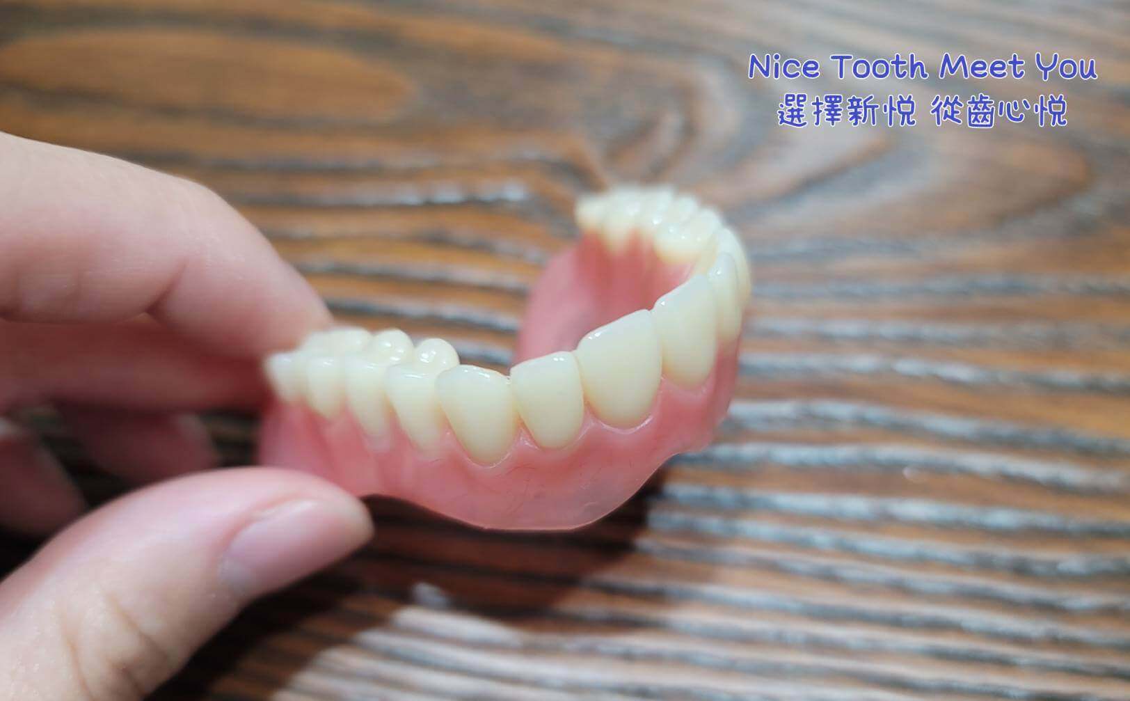 活動式假牙有不可被取代的特色！　新悅美學牙醫診所的第3張圖片