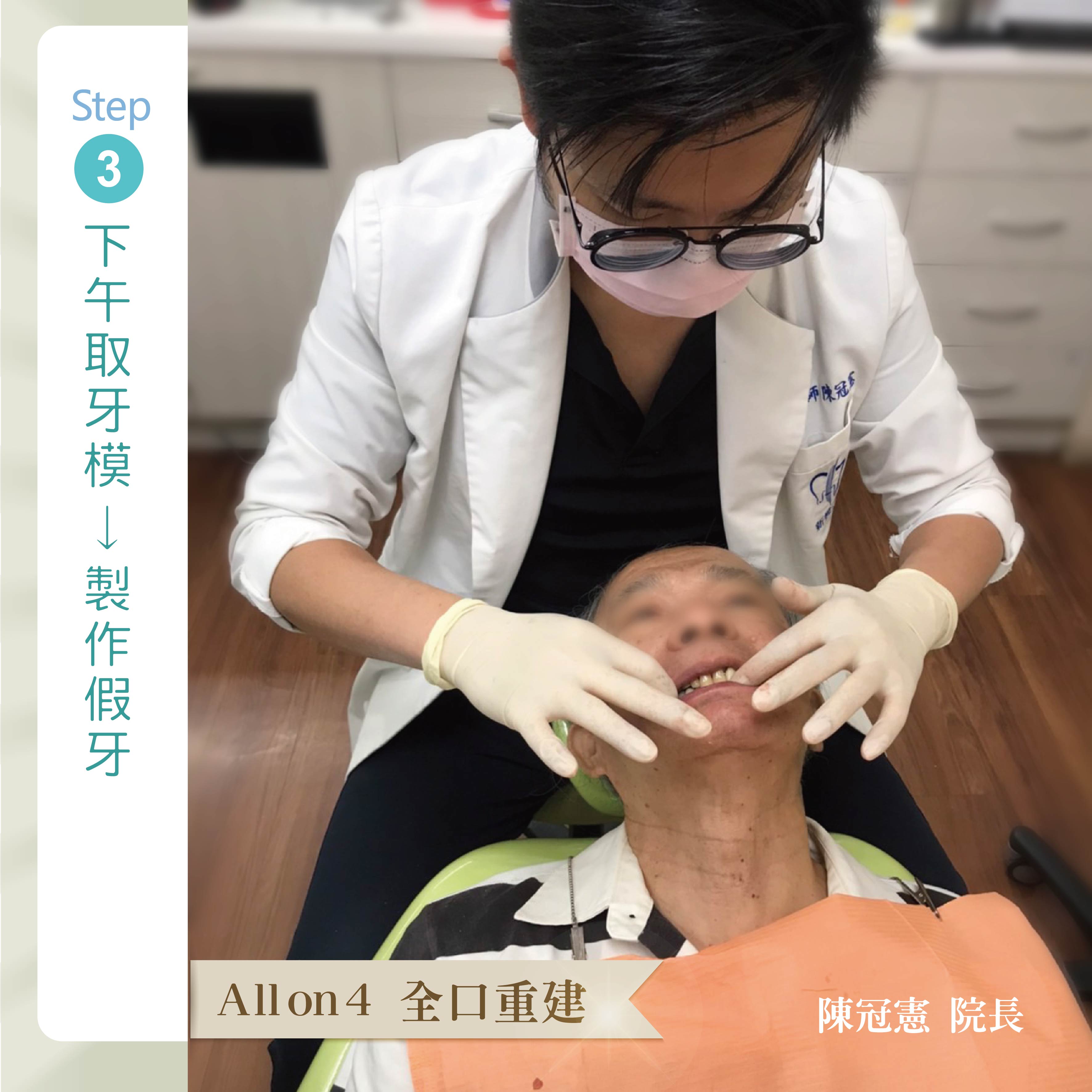 [新悅美學牙醫案例] 王老闆的 All on 4 微笑見證的第3張圖片