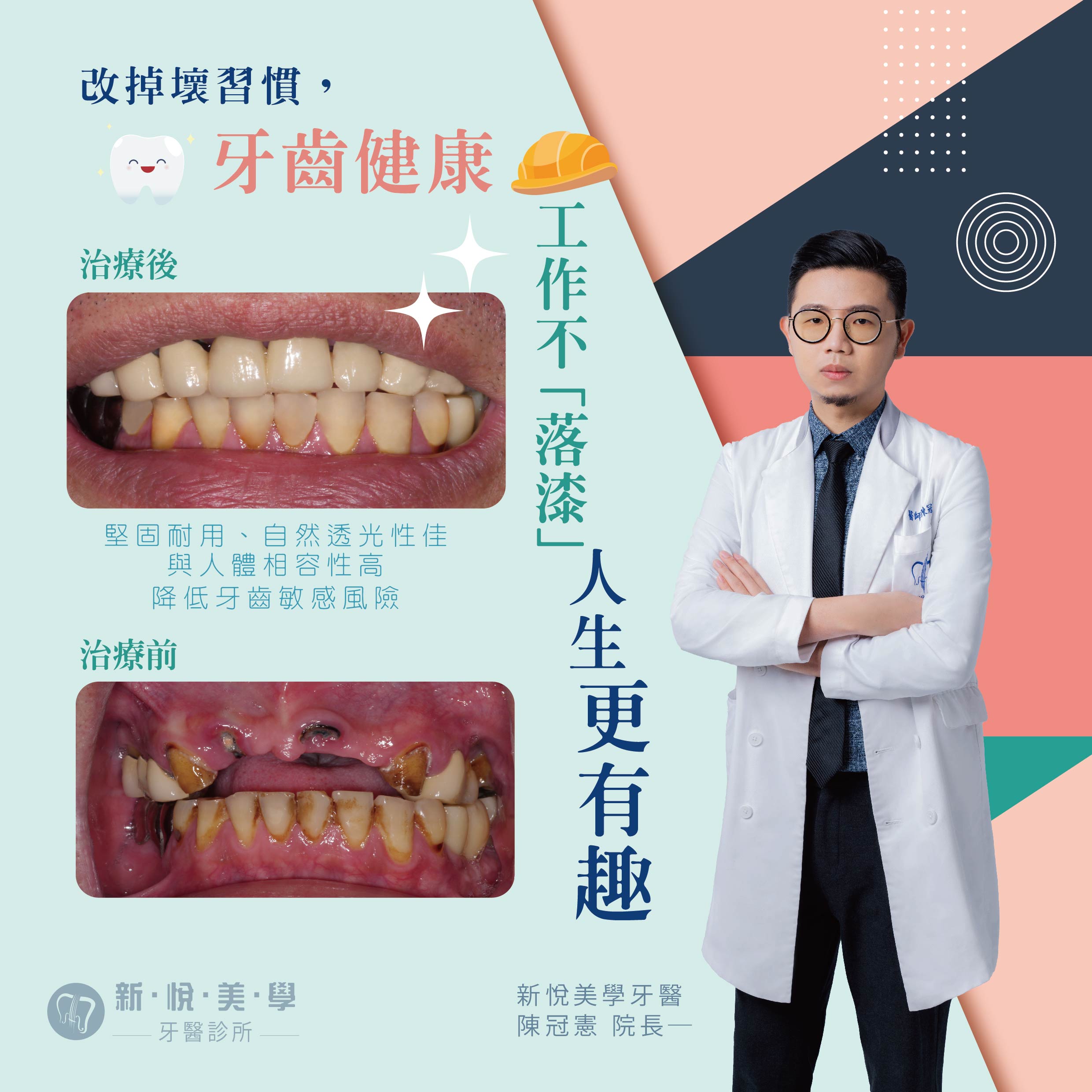 [新悅美學牙醫案例]  改掉壞習慣，牙齒健康，工作不落漆人生更有趣的第1張圖片