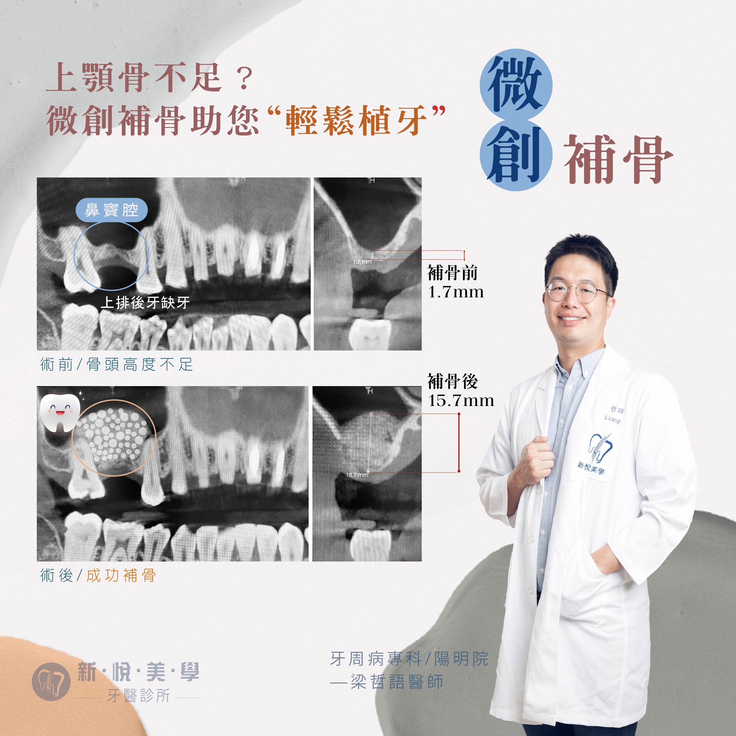 新悅美學牙醫診所的案例分享圖片