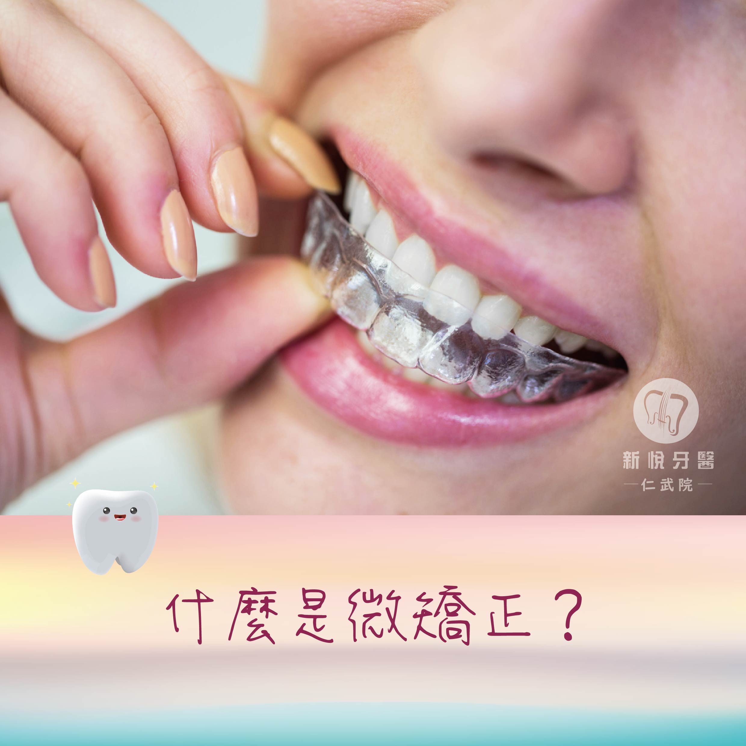 新悅美學牙醫診所的牙醫衛教案例圖片