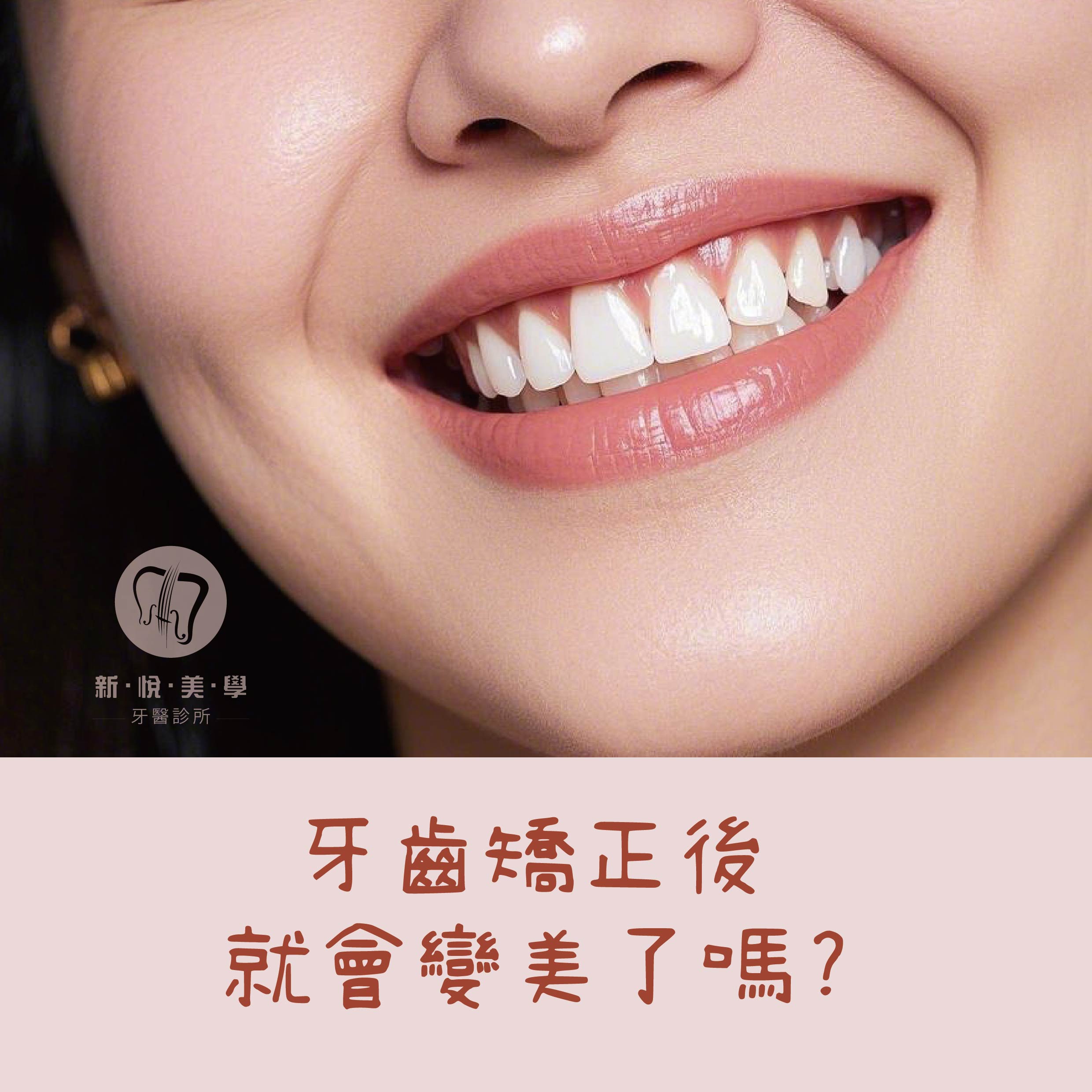 新悅美學牙醫診所的衛教專區圖片