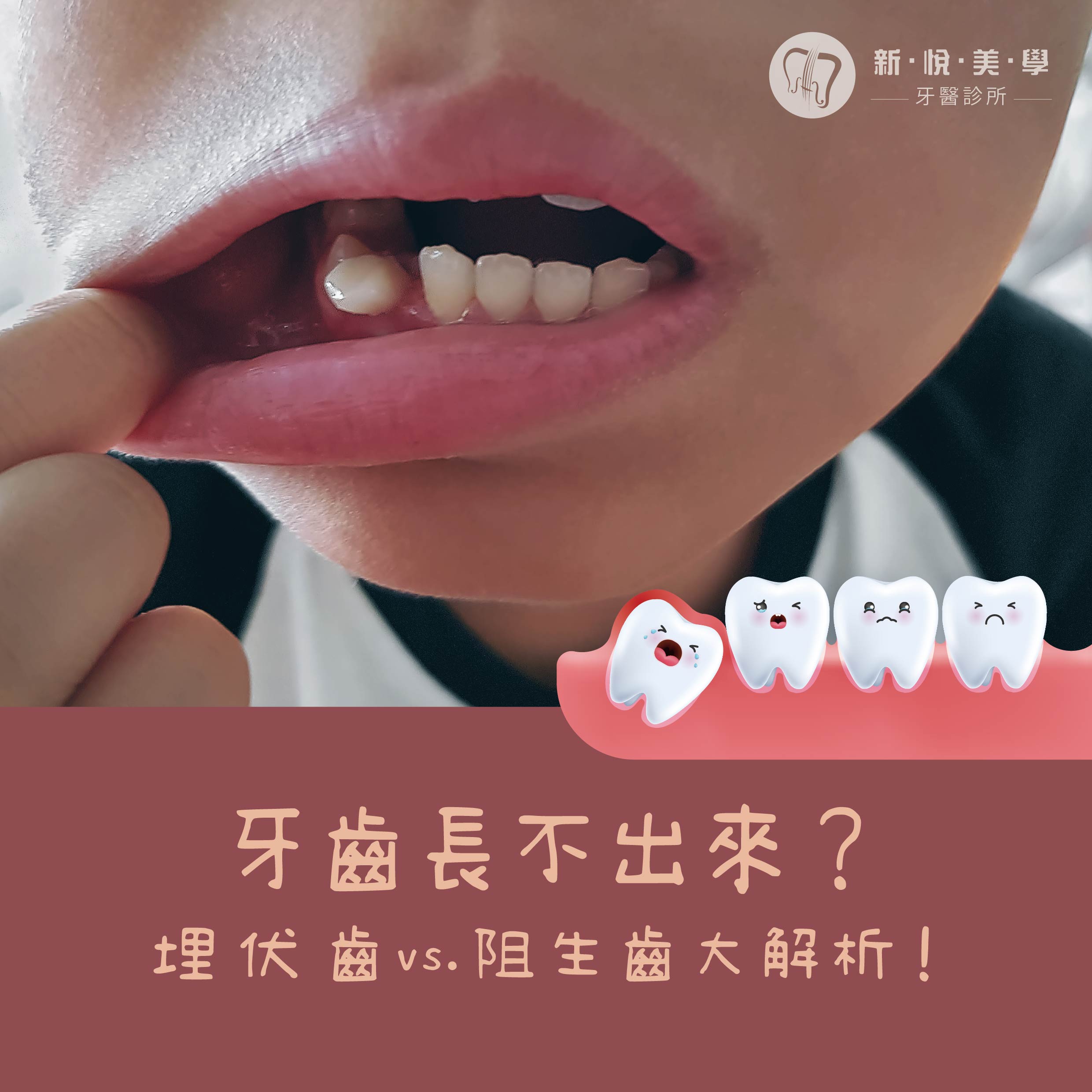 新悅美學牙醫診所的牙醫衛教案例圖片