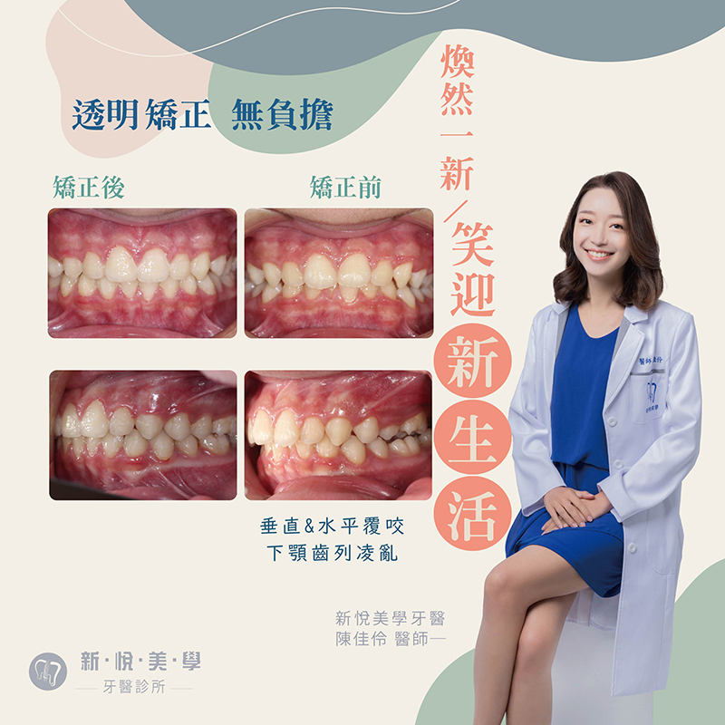 新悅美學牙醫診所的案例分享圖片