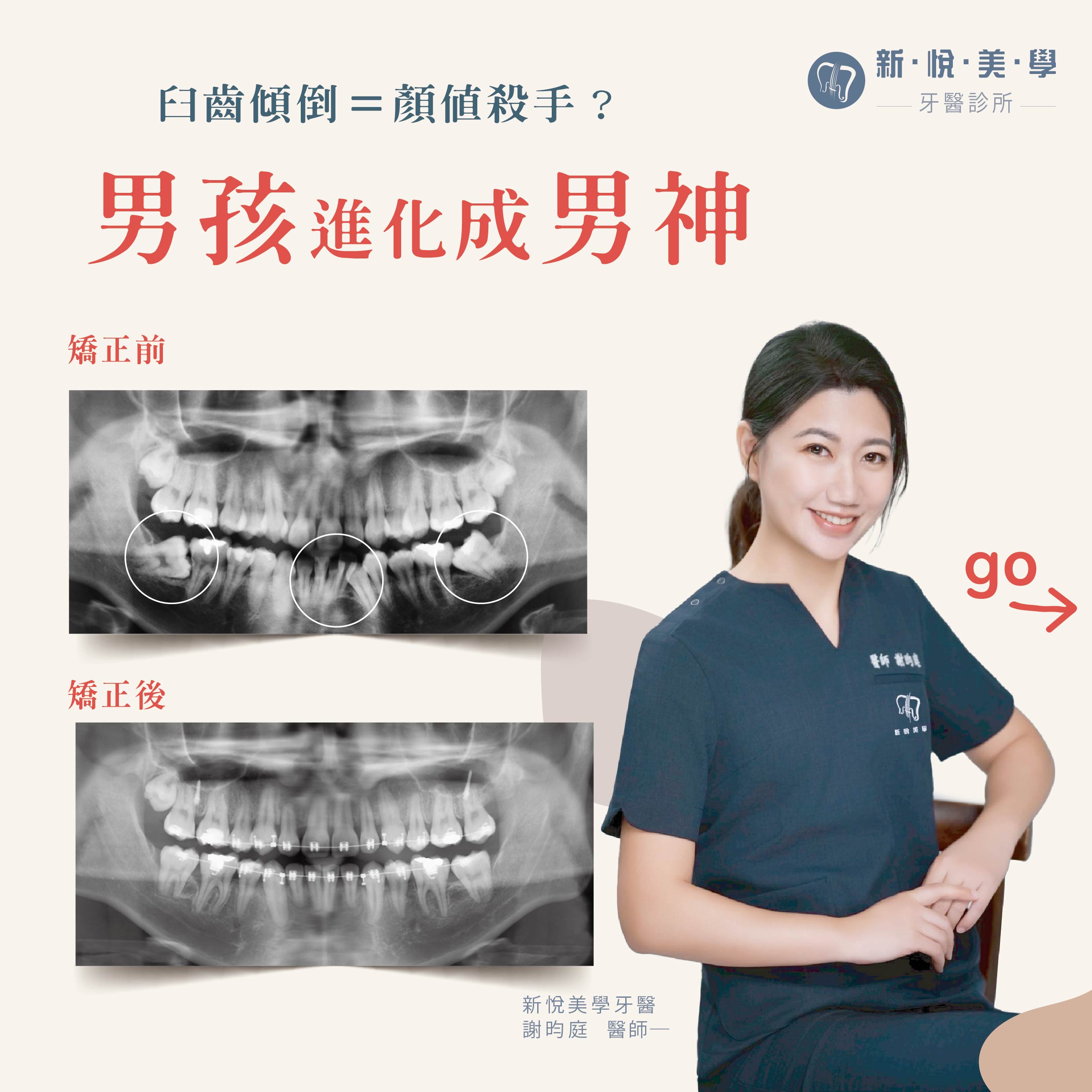 新悅美學牙醫診所的案例分享圖片