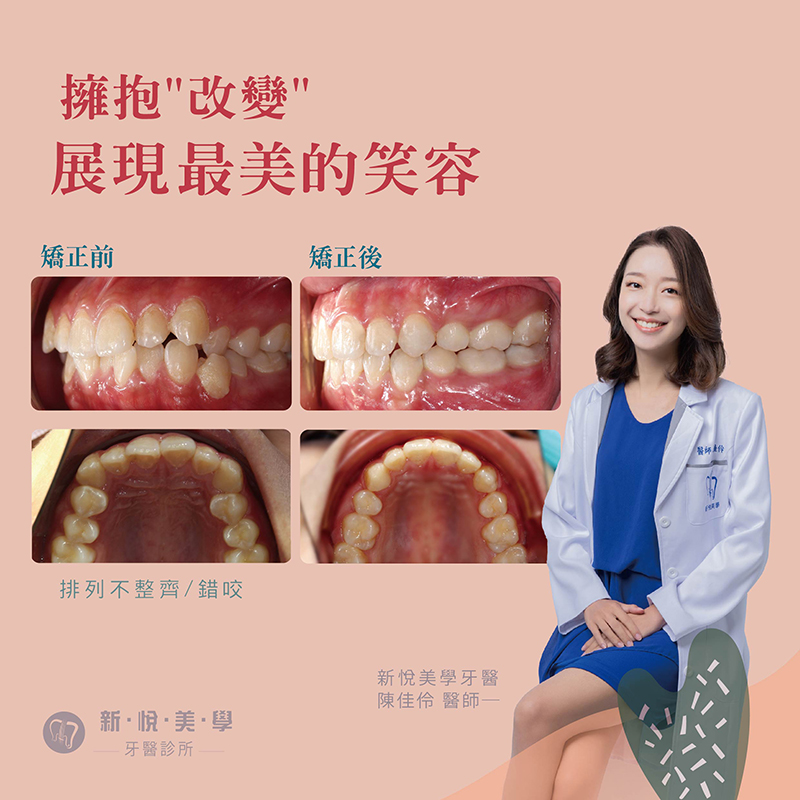 新悅美學牙醫診所的案例分享圖片