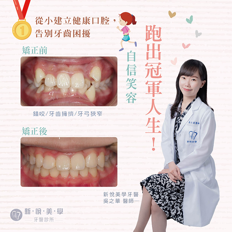 新悅美學牙醫診所的案例分享圖片