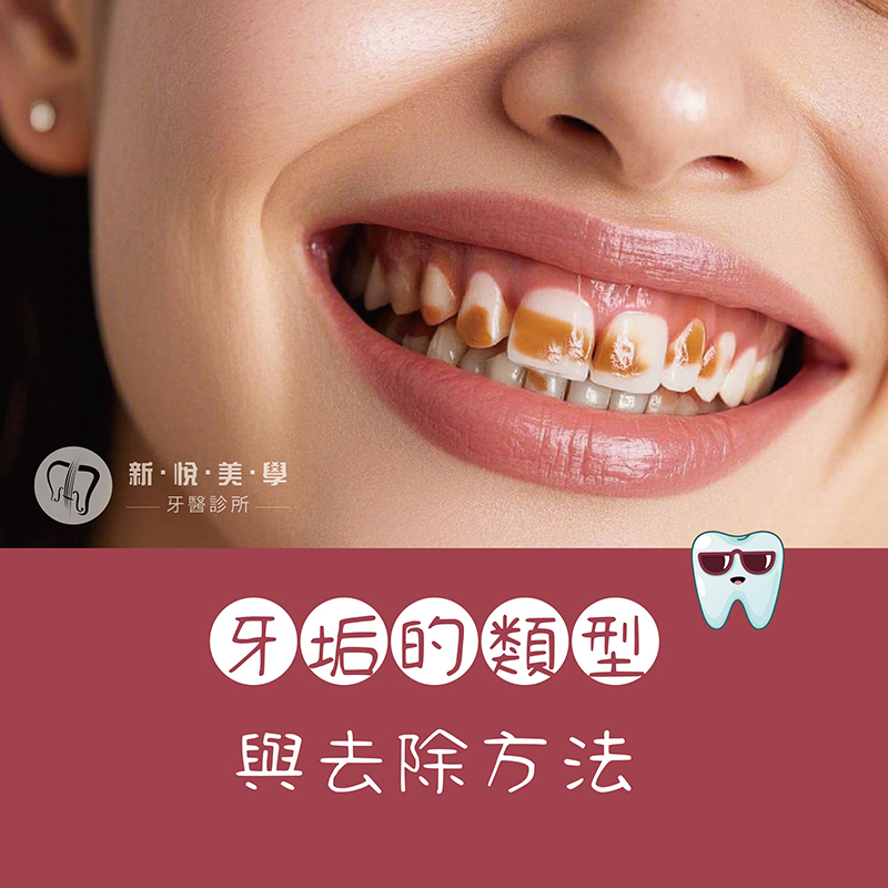 新悅美學牙醫診所的牙醫衛教案例圖片