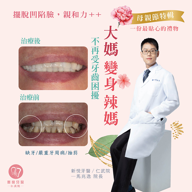 新悅美學牙醫診所的案例分享圖片