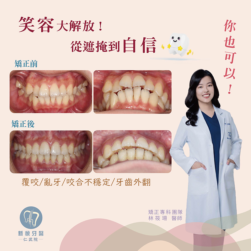 新悅美學牙醫診所的案例分享圖片