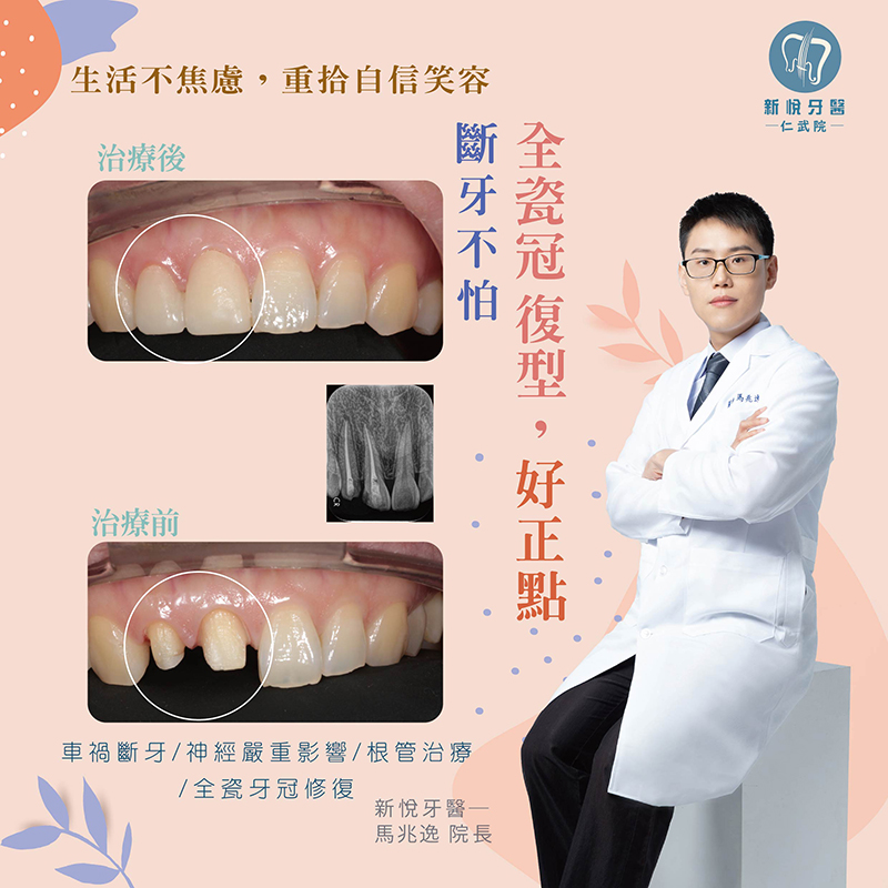 新悅美學牙醫診所的案例分享圖片