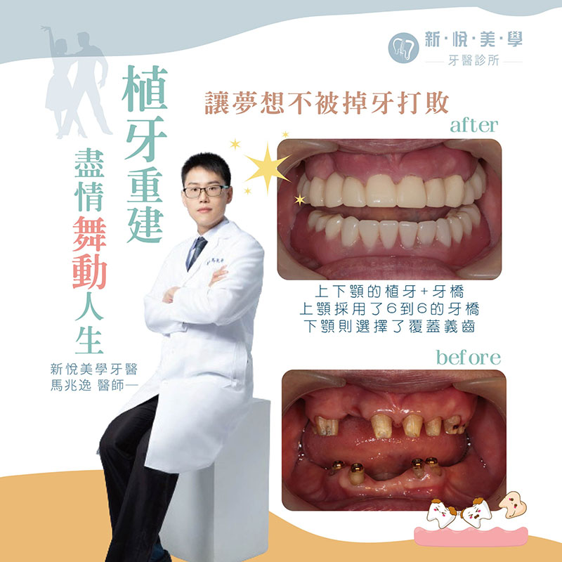 新悅美學牙醫診所的案例分享圖片