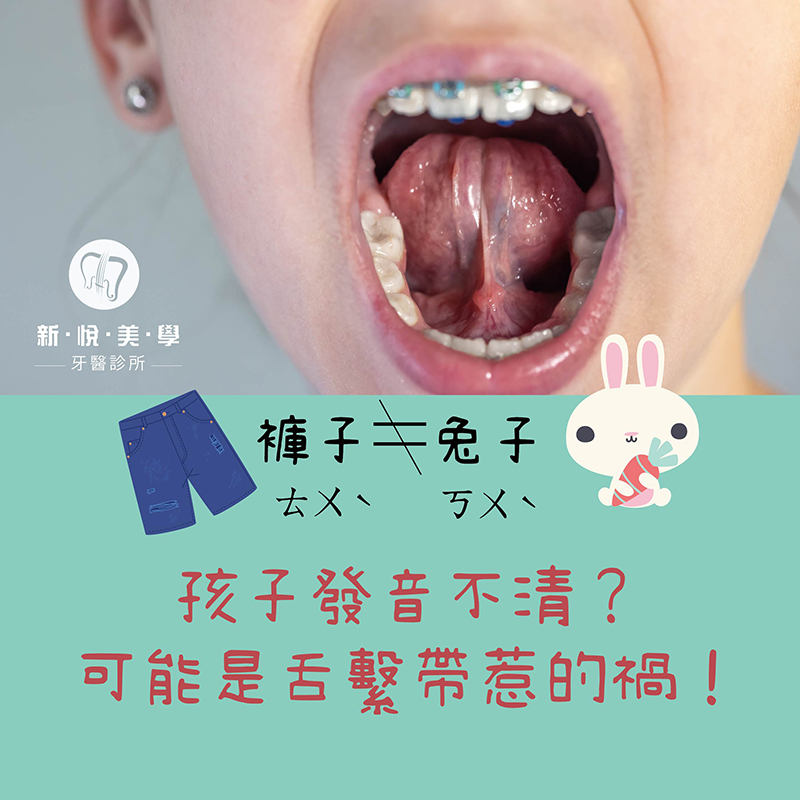 新悅美學牙醫診所的牙醫衛教案例圖片