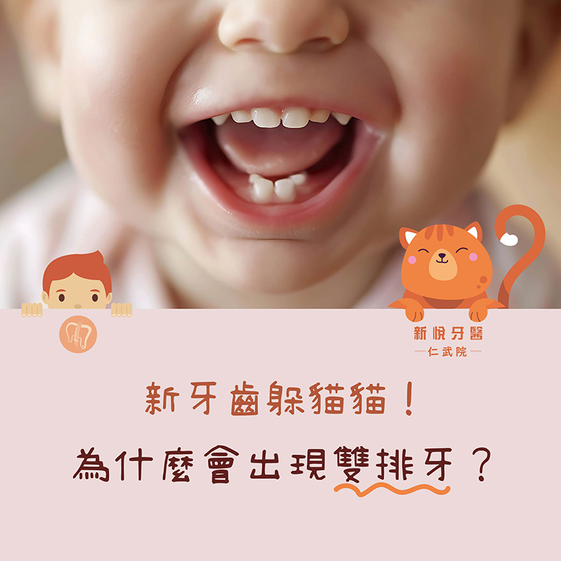 新悅美學牙醫診所的牙醫衛教案例圖片