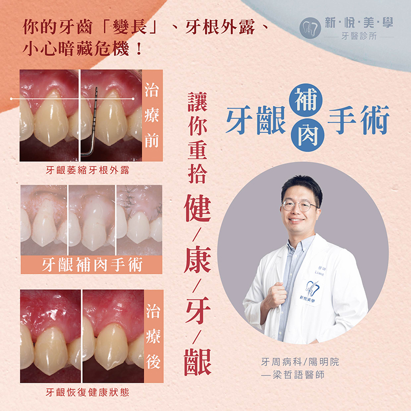 新悅美學牙醫診所的案例分享圖片